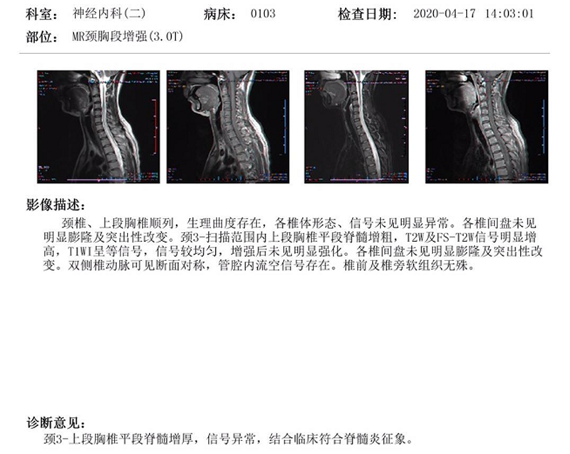 11.3治療前.png