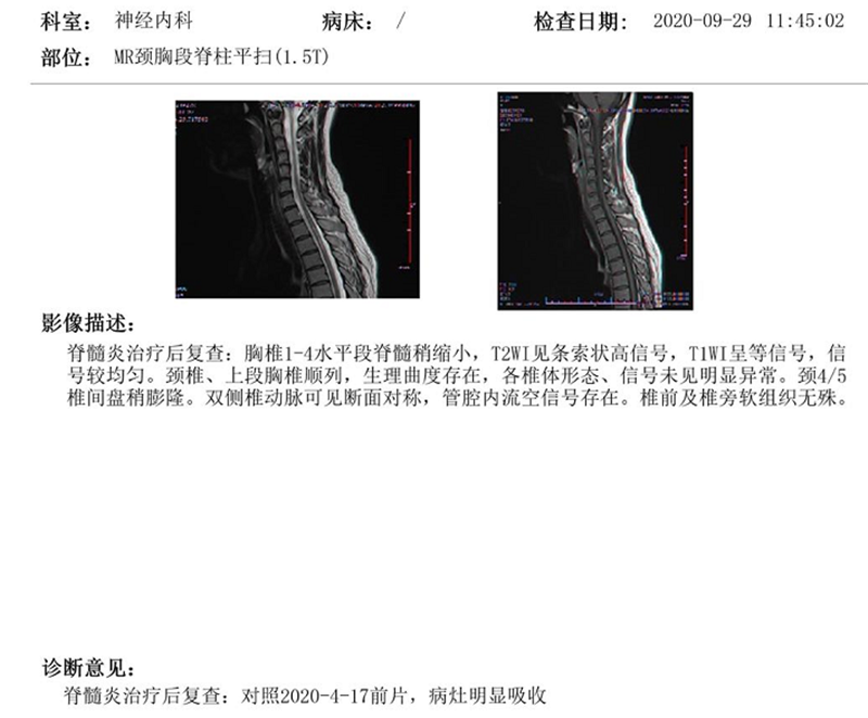11.3治療后.png